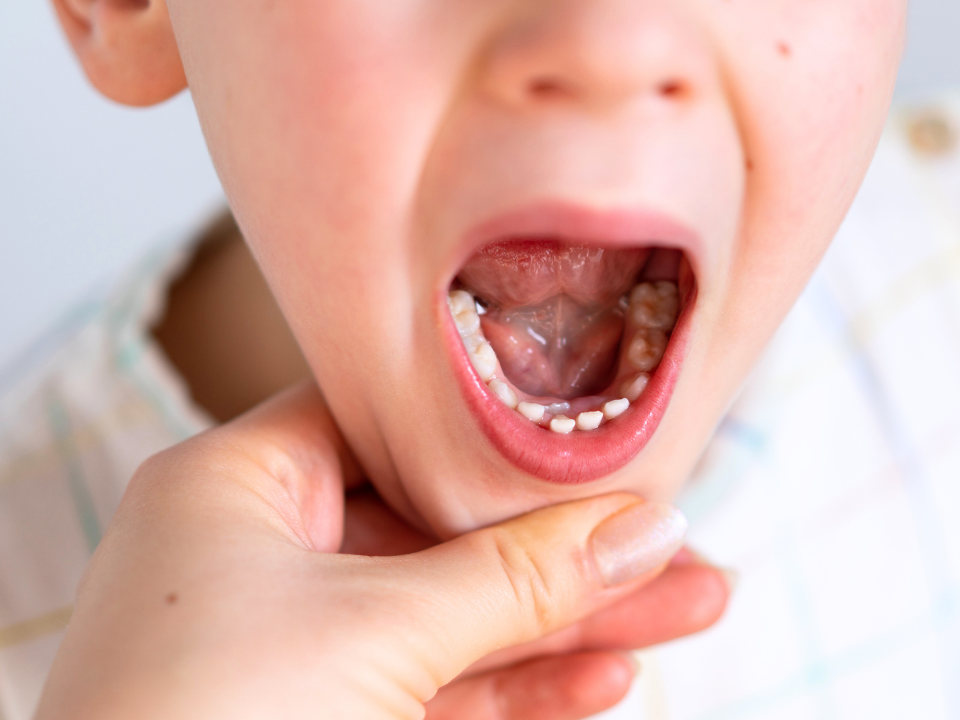 子供が口を開けている